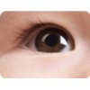 斜视小儿眼病治疗 强烈推荐，可靠的斜弱视小儿眼病治疗
