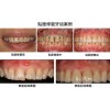 周到的廊坊牙齿瓷贴面推荐_廊坊牙齿瓷贴面价格